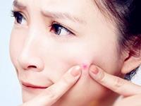 12星座女长痘后的第一反应