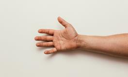 梦见猴是什么意思