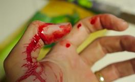 梦见自己身上流血是什么意思