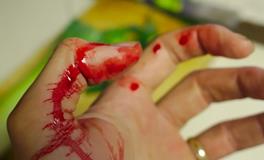 梦见亲人全身是血运势好不好