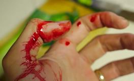 孕妇梦见流血见红了